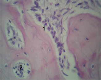 РЕМОДЕЛИРОВАНИЕ костной ткани через 1 месяц